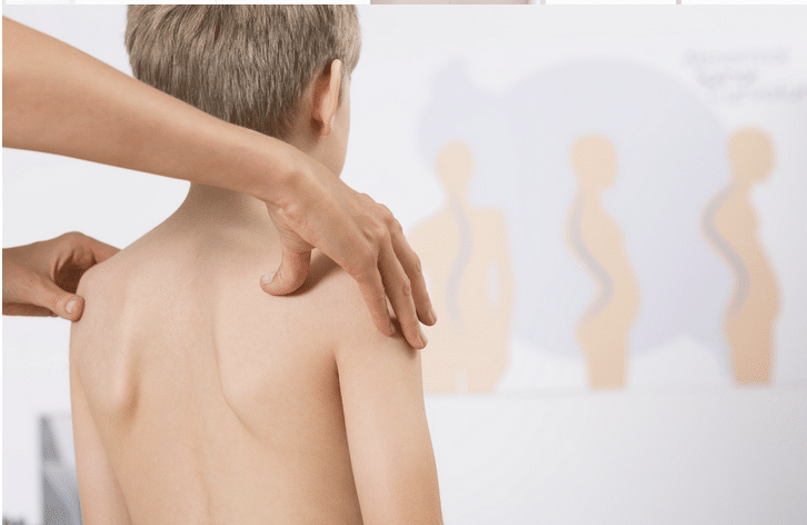 Therapist measuring scapular winging on a school aged boy